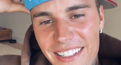 ¿Justin Bieber ya se está recuperando tras parálisis facial? Esto es lo que sabemos