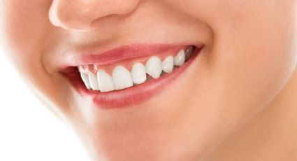 ¿El bicarbonato blanquea los dientes amarillos? Esto dicen los dentistas