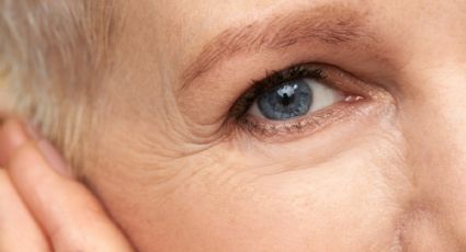 Aplica estas vitaminas en las arrugas de los ojos para estirar la piel SIN cirugía
